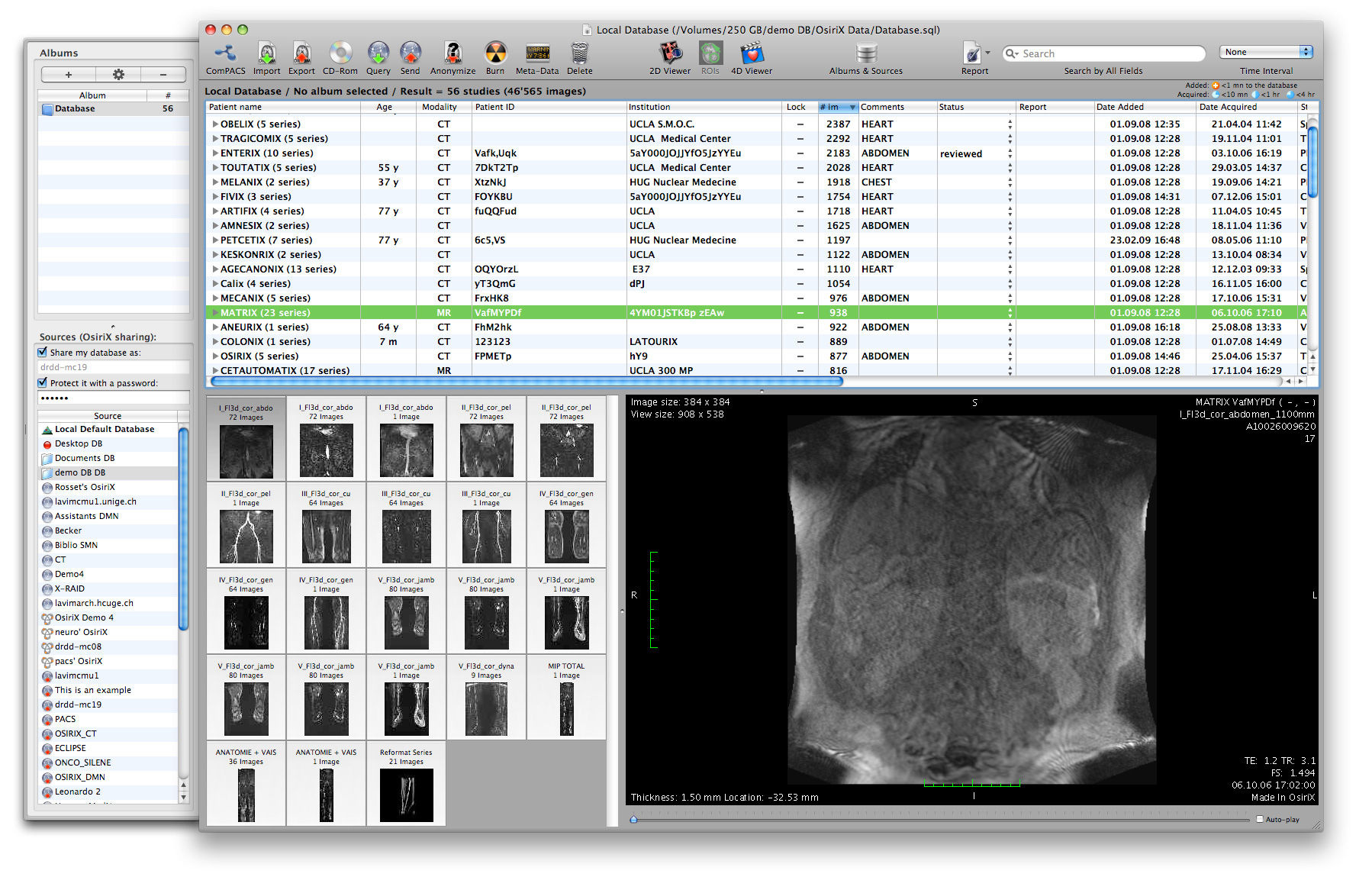 how to measure with osirix lite