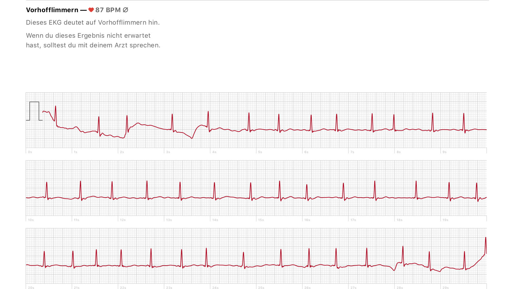 Herzspezialist: "Das EKG der Apple Watch ist hervorragend" | heise online